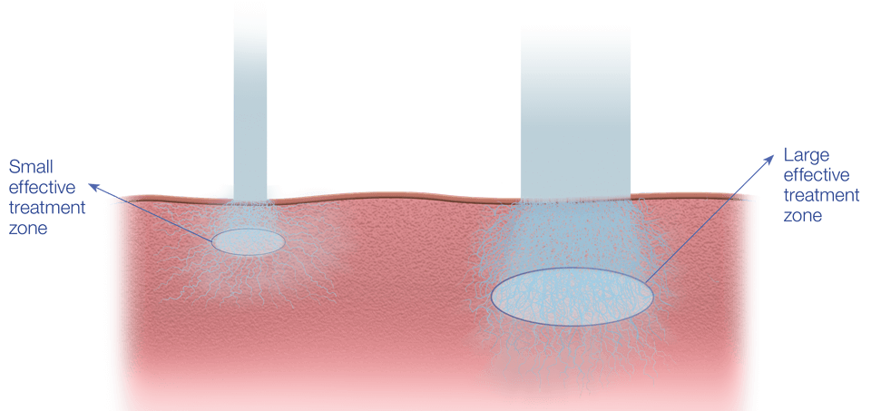Deep-Reach-Desktop-960-453